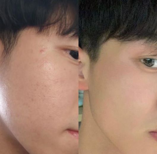 男士洗面奶哪个牌子最好？盘点十款高口碑男士洗面奶品牌精选推荐(图5)